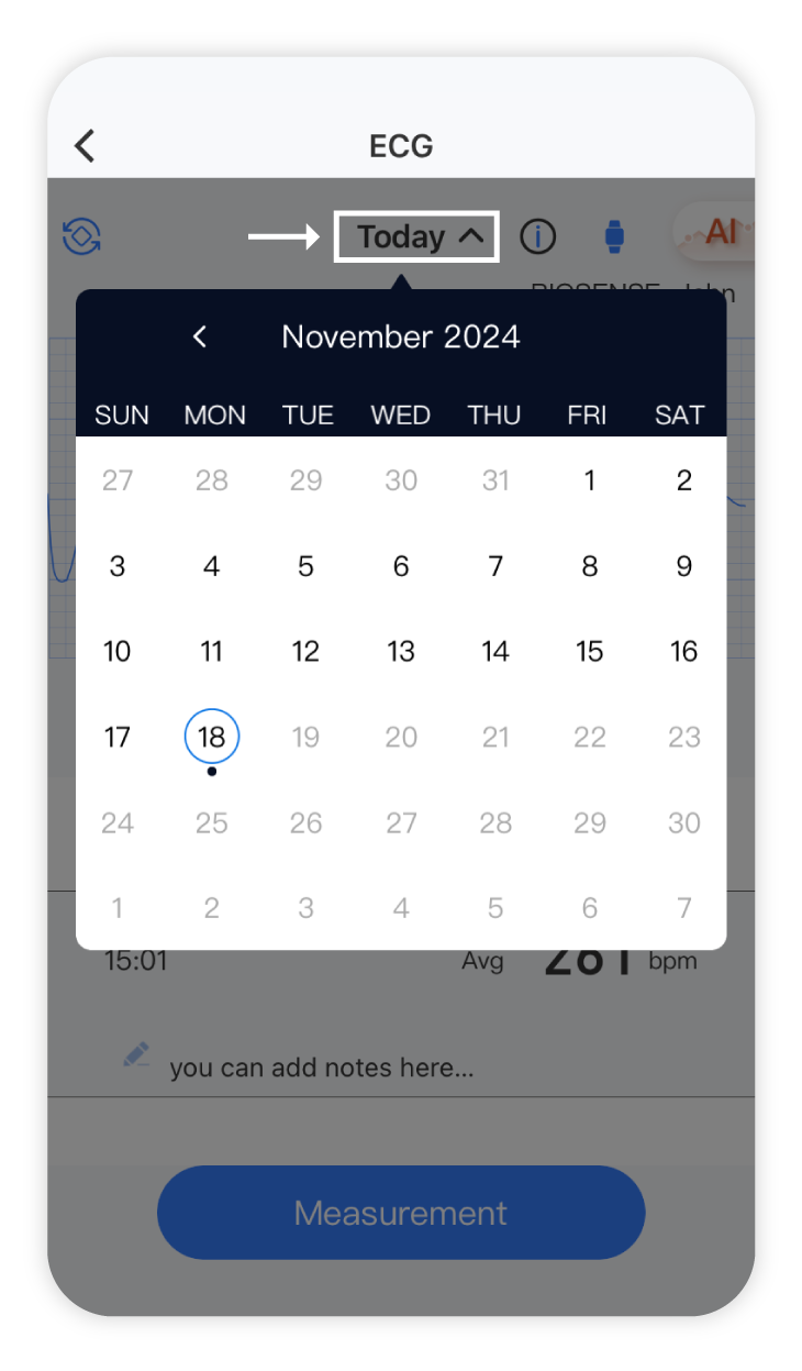 ECG-calendar.png